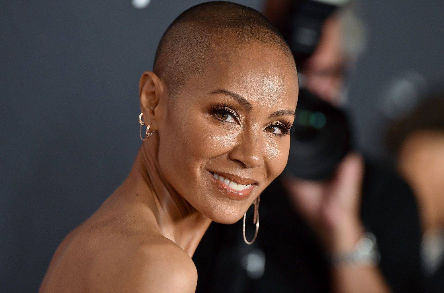 What Hair Loss Does Jada Pinkett Smith Have